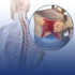 Knee Replacement Icon
